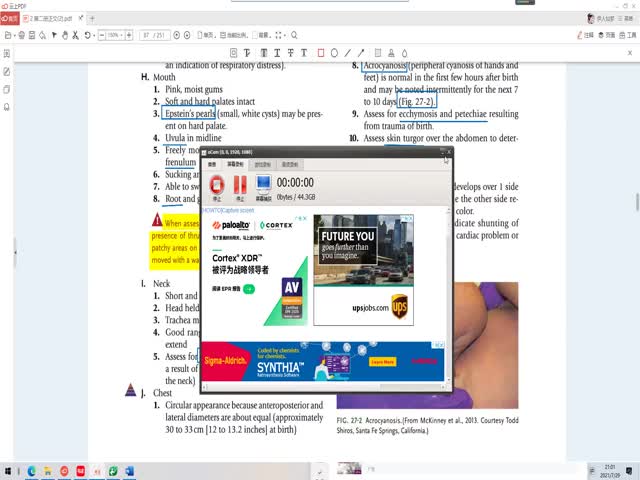 添翼2021年度ISPNRN專業(yè)課27章&nbsp;新生兒護(hù)理