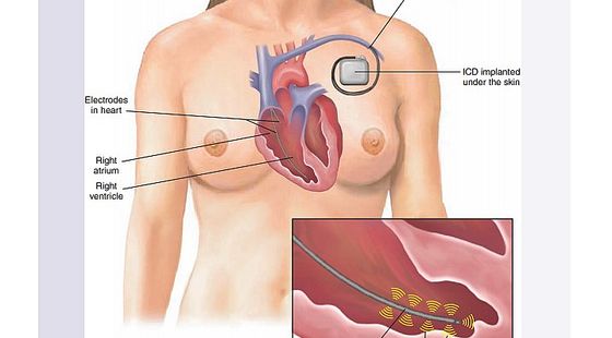 試聽(tīng)課3--基礎(chǔ)詞匯&nbsp;Chapter8&nbsp;Cardiovascular&nbsp;System&nbsp;心血管系統(tǒng)
