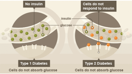 添翼2017-2018年ISPN/RN專業(yè)課&nbsp;36章&nbsp;代謝與內(nèi)分泌疾病